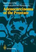 Clinical Practice in Urology - Adenocarcinoma of the Prostate