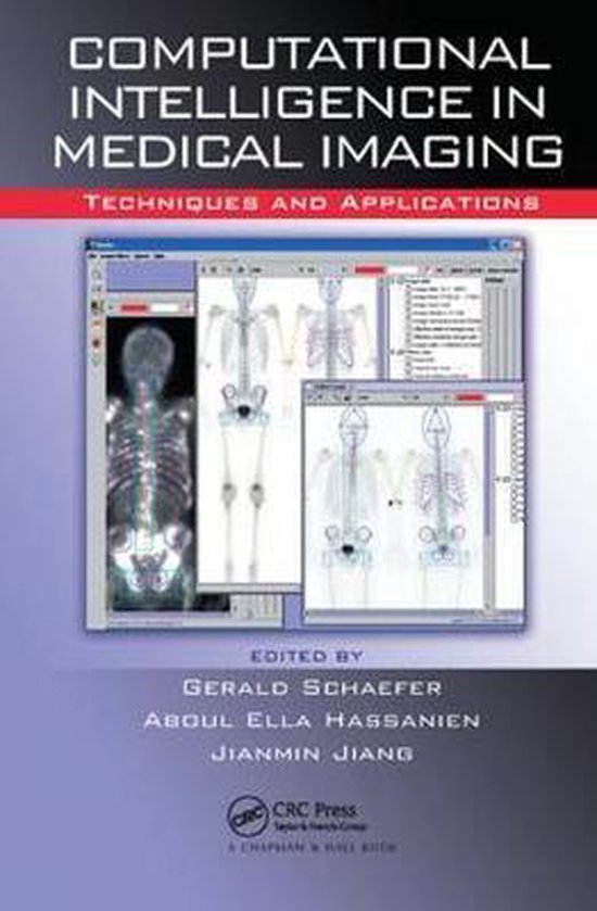 Computational Intelligence in Medical Imaging | 9781138112209 | Boeken ...