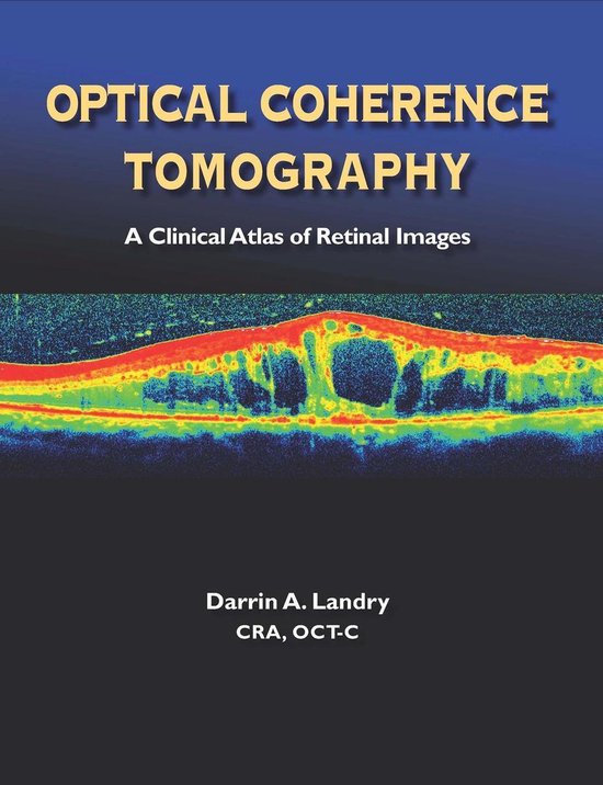 Optical Coherence Tomography a Clinical Atlas of Retinal Ima ... - cover