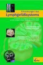 Erkrankung des Lymphgefäßsystems