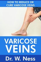 Varicose Veins: How To Reduce Or Cure Varicose Veins