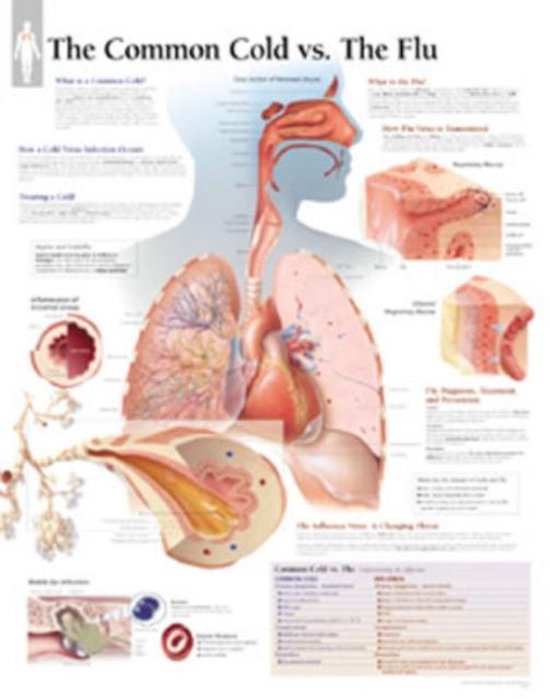 Foto: Common cold vs the flu laminated poster