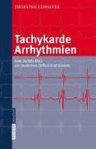 Tachykarde Arrhythmien