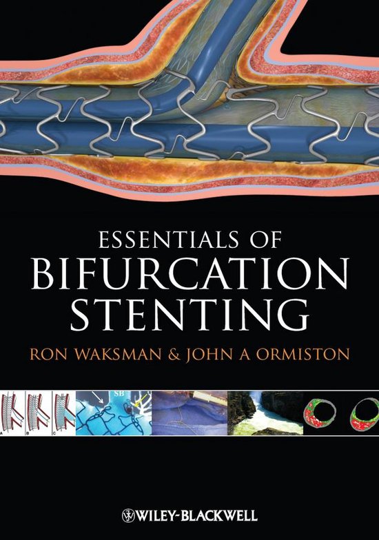 Bifurcation Stenting - cover