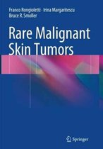 Rare Malignant Skin Tumors