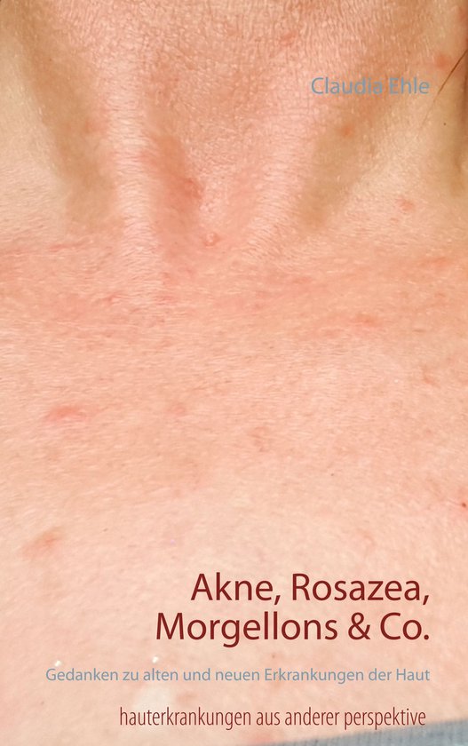 Akne, Rosazea, Morgellons & Co.