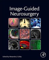 Image Guided Neurosurgery