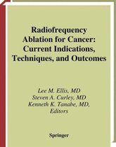 Radiofrequency Ablation for Cancer