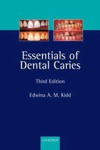 Essentials Of Dental Caries