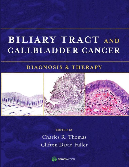 Biliary Tract and Gallbladder Cancer - cover