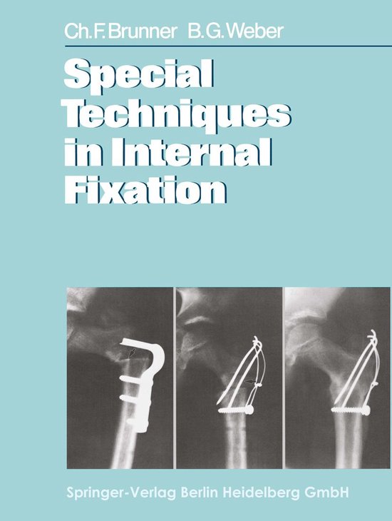 Medicine (R0) - Special Techniques in Internal Fixation - cover