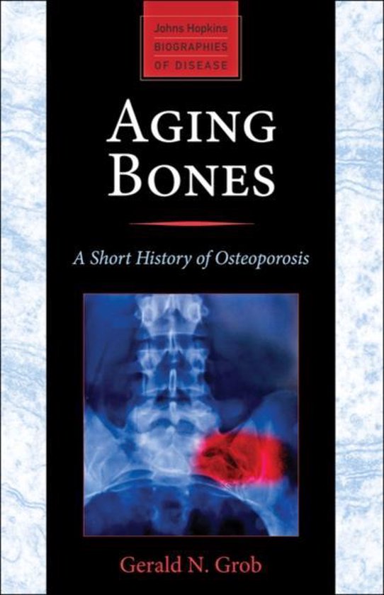 Aging Bones - A Short History of Osteoporosis - cover