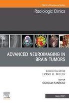 The Clinics: Radiology Volume 59-3 - Advanced Neuroimaging in Brain Tumors, An Issue of Radiologic Clinics of North America, E-Book