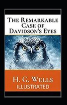 The Remarkable Case of Davidsons Eyes Illustrated