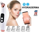 HydraDerma® - Blackhead Remover – Met Ingebouwde Camera 5 megapixel - Mee eter verwijderaar - vacuum cleaner - Puisten verwijderaar