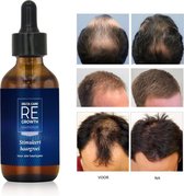 Regrowth | Haargroei serum - Alternatief voor Minoxidil 5% - Haargroei stimuleren - Minoxidil - Baardgroei - Haargroei Producten tegen Haaruitval - Haar Vitamines - Biotine Haar - Haargroei O