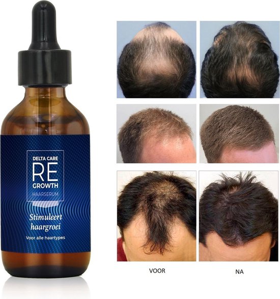 Regrowth | Haargroei serum - Alternatief voor Minoxidil 5% - Haargroei stimuleren - Minoxidil - Baardgroei - Haargroei Producten tegen Haaruitval - Haar Vitamines - Biotine Haar - Haargroei Olie - Haar Serum - Baardolie - Haarserum - Haarolie