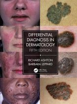 Differential Diagnosis in Dermatology