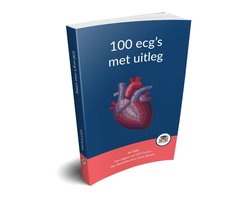 Omslag van 100 ecg's met uitleg - Hét ECG-boek van 2021