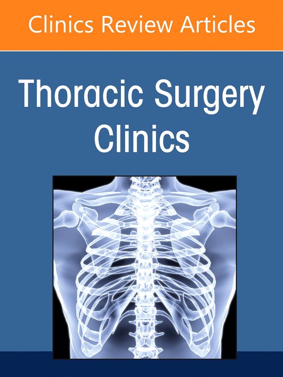 The Clinics: Internal Medicine Volume 32-2 - Lung Transplantation, An Issue of Thoracic Surgery Clinics , E-Book