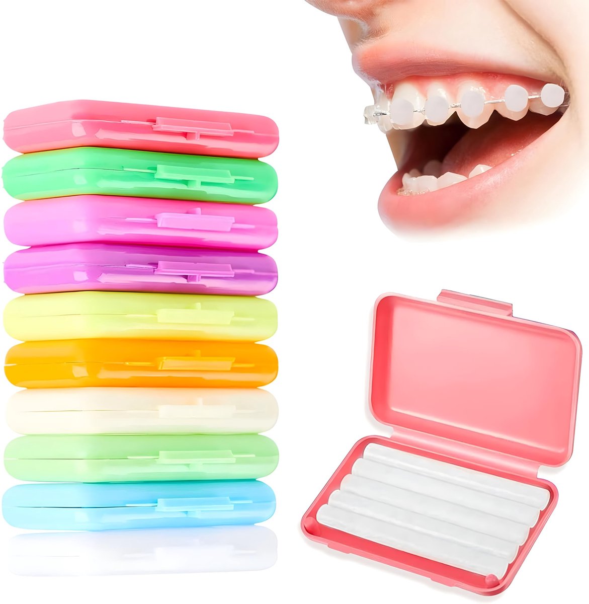 Solidchoice - Orthodontische Wax voor Braces in 10 Verschillende Smaken