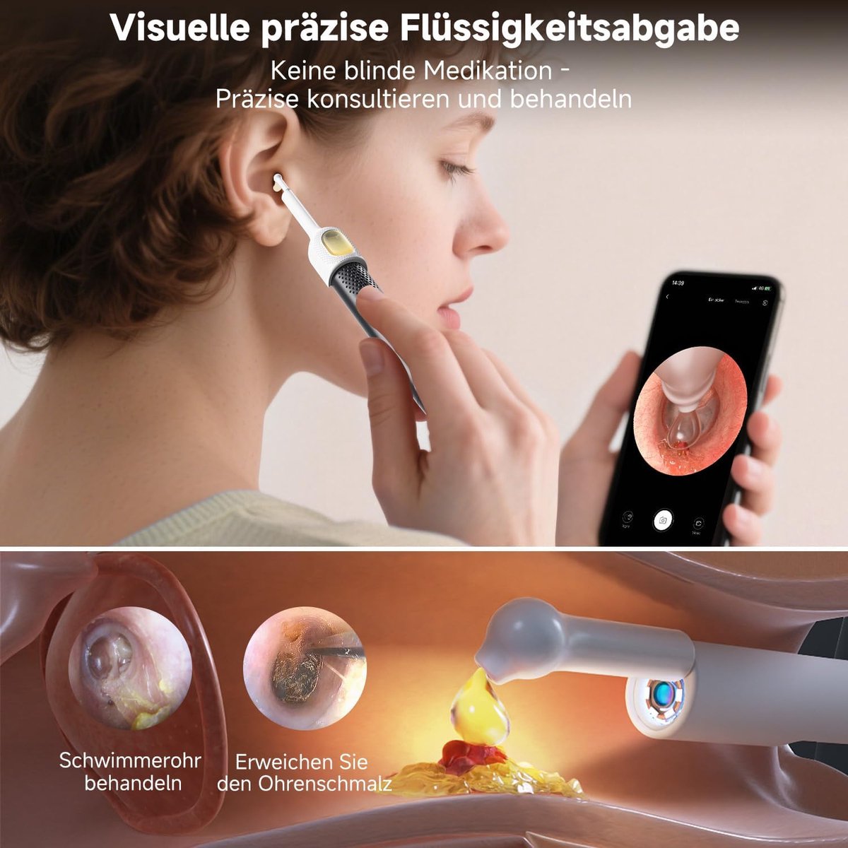Orenreiniger oordreiniger met camera, otoscoop voor oorreiniging, visuele orenreiniger Voordeelset 1-delig, orenreiniger met otoscoop, set met pincet & druppelfles, 1080P HD wifi met pincet voor volwassenen, kinderen en baby's