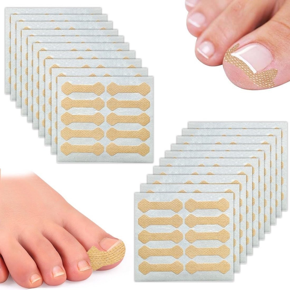 Complete Set voor het Corrigeren van Ingroeiende Teennagels met 200 Pcs, Ademend Patches en C Pads voor Professionele Nagelverzorging en Pijnverlichting