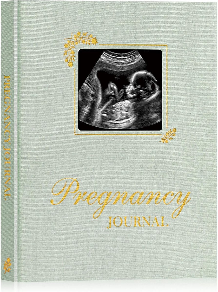 SnelShoppen - My Pregnancy Journal Memory Book voor Eerste Moeders, 156 Pagina's Zwangerschap Planner, Dagboek en Scrapbook voor Verwachte Ouders, Onm