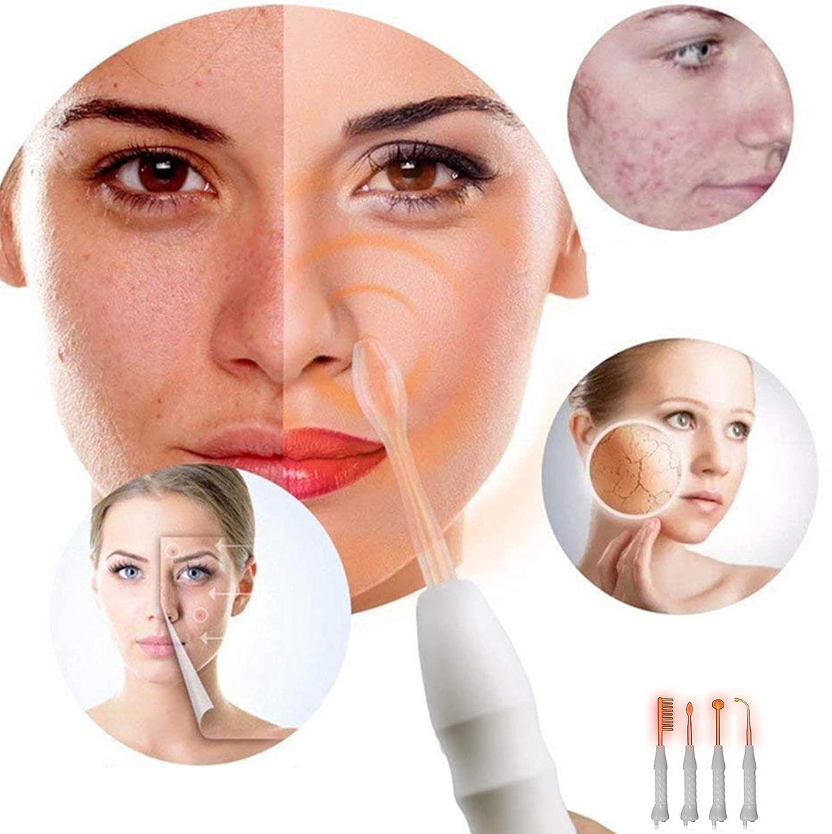 Hoogfrequent Gezichtsapparaat Met 4 Opzetstukken - Acne- Rimpel- En Vlekbehandeling Draagbaar 10W-Apparaat - Professioneel Thuisgebruik - Wit