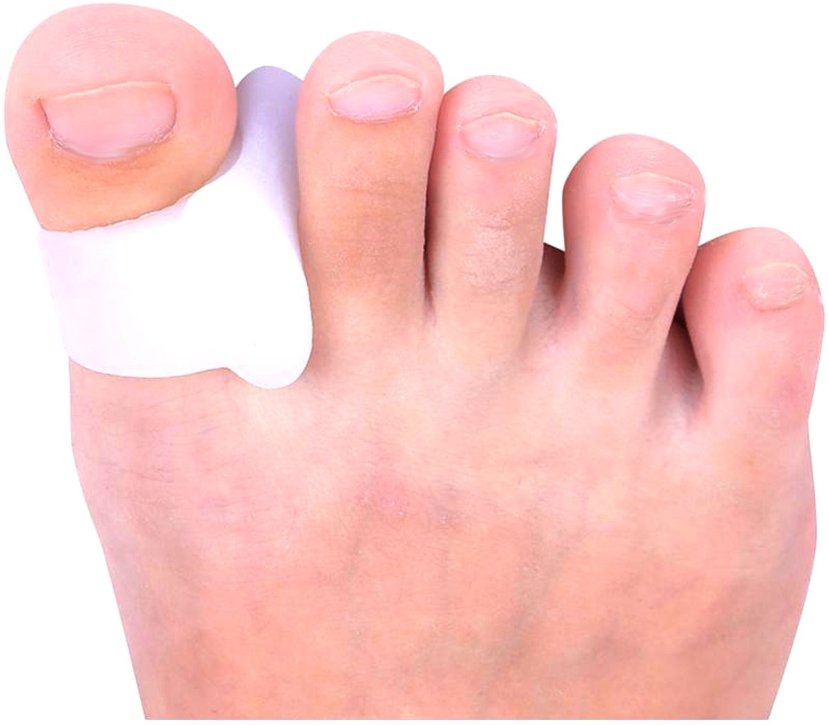 Gel Separator Grote Teen met Lus - Hallux Correctie