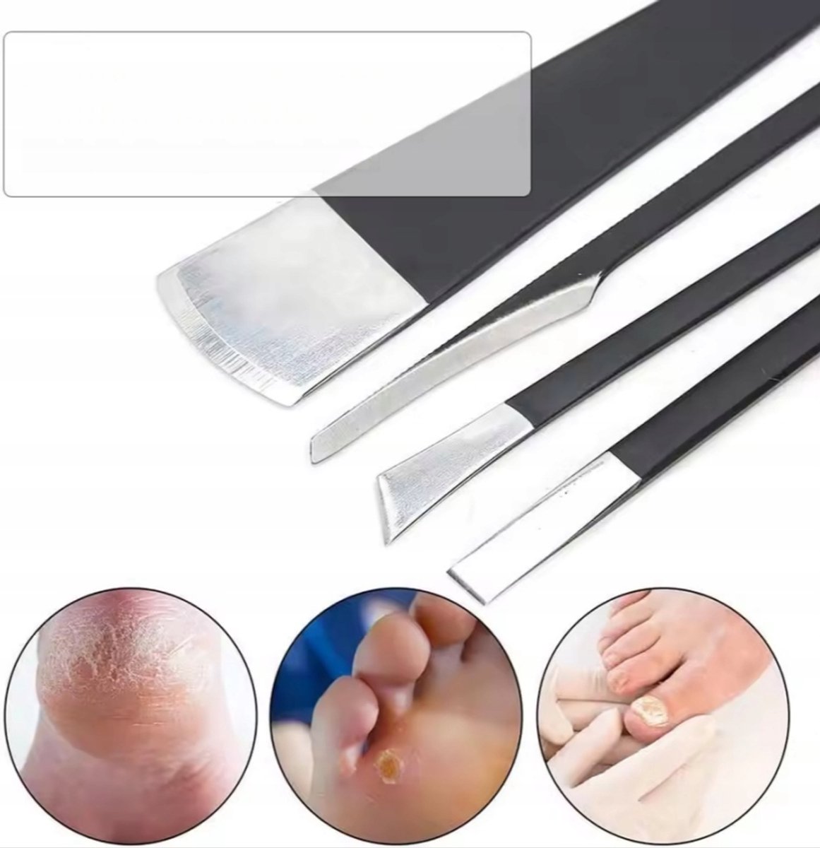 Pedicure Messenset Voetverzorging - 5 Delig RVS