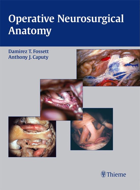 Operative Neurosurgical Anatomy - cover