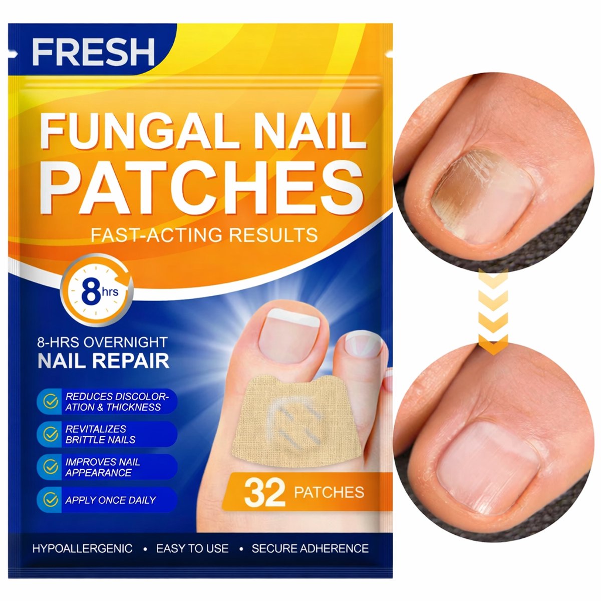 FRESH Kalknagel Behandeling Pleisters – 32 Stuks – Intensieve Overnight Verzorging bij Schimmelnagel & Verdikte Nagels – 8 Uur Actieve Nagelherstel Support