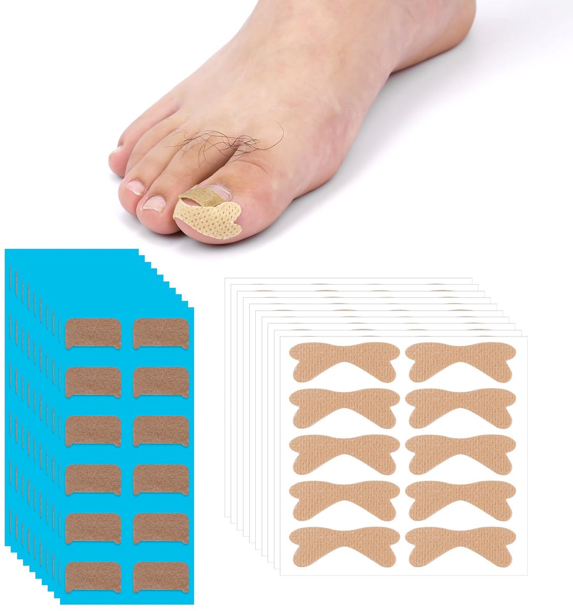 Ingrown Toenail Corrector - Ademend Correctiepleister - 100 Stuks