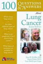 100 Questions and Answers About Lung Cancer