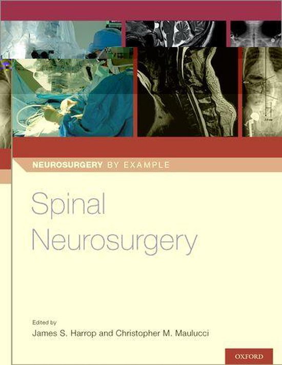 Neurosurgery by Example - Spinal Neurosurgery - cover