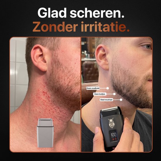 Vergelijking van huid na scheren: links met roodheid en bultjes, rechts glad.