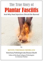 The True Story of Plantar Fasciitis
