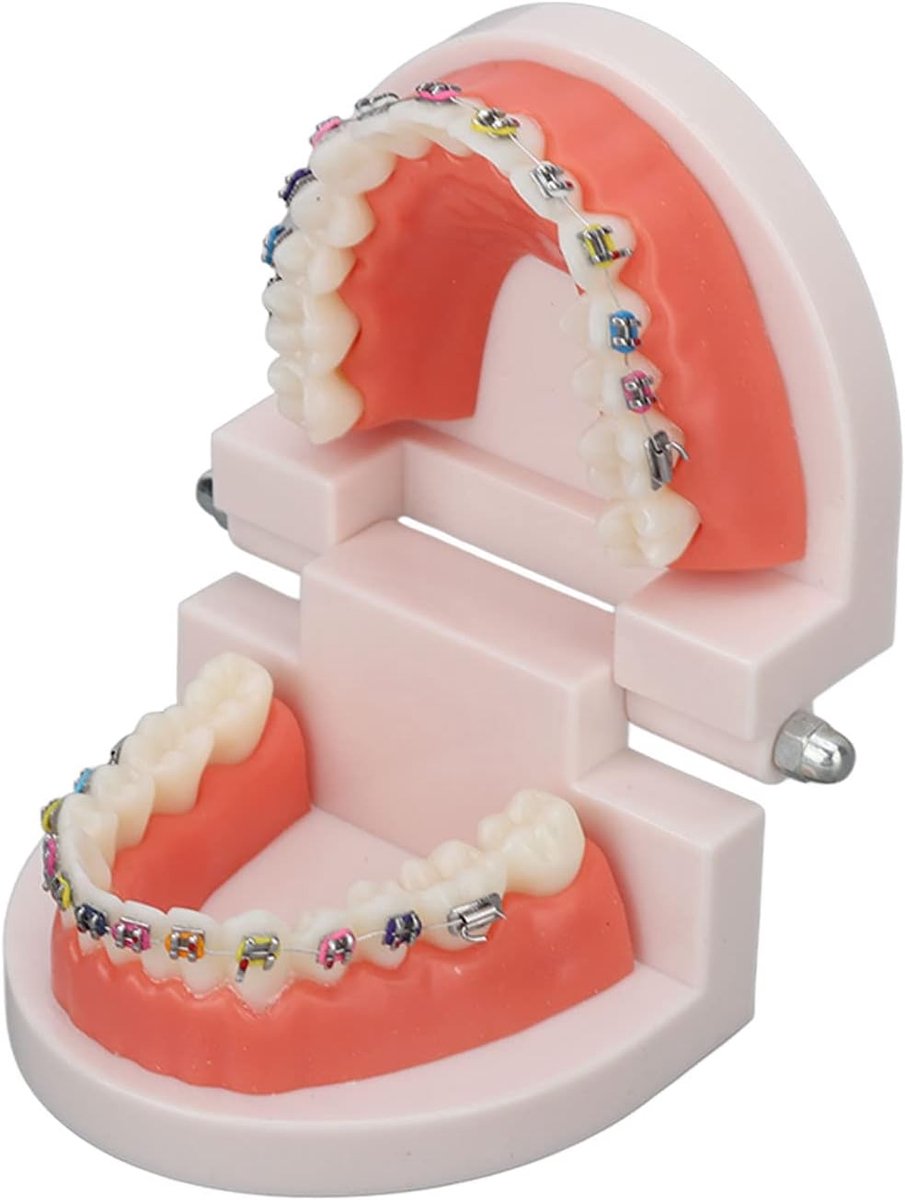 SnelShoppen - Orthodontisch Tandmodel Typodont met Metaaldraad en Beugels - Educatief Leer- en Interpretatiemodel voor Volwassenen en Kinderen