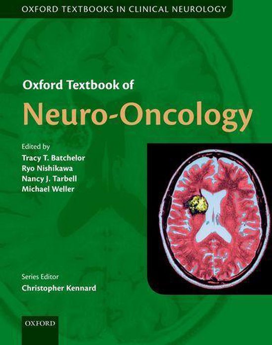 Bol Com Oxford Textbook Of Neuro Oncology Ebook Boeken