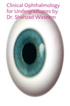 Clinical Ophthalmology for Undergraduates by Shahzad Waseem