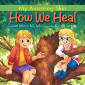 My Amazing Skin- How We Heal