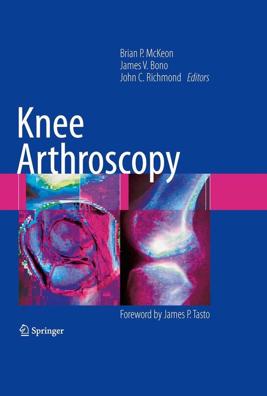 Medicine (R0) - Knee Arthroscopy - cover