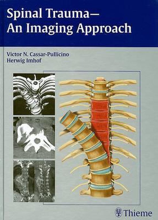 Spinal Trauma - cover