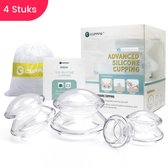 iCupping Cellulite Massage Cups - 4 tailles différentes - Ventouses contre la cellulite - Robustes - Transparentes - Silicone de qualité alimentaire