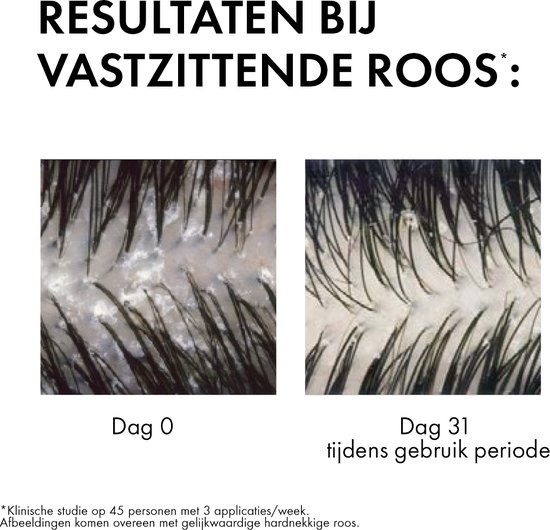 Vichy Dercos Technique Anti-Roos DS Shampoo - Normaal tot Vet haar - 390ml