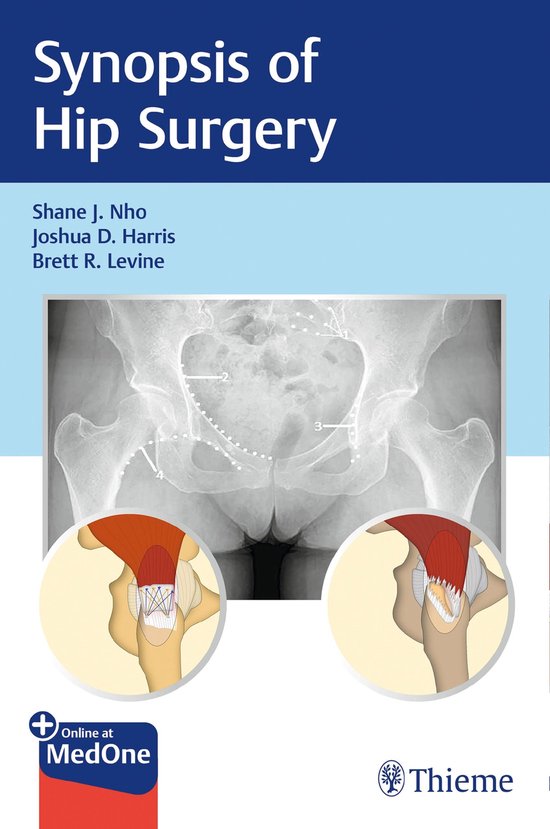 Synopsis of Hip Surgery - cover