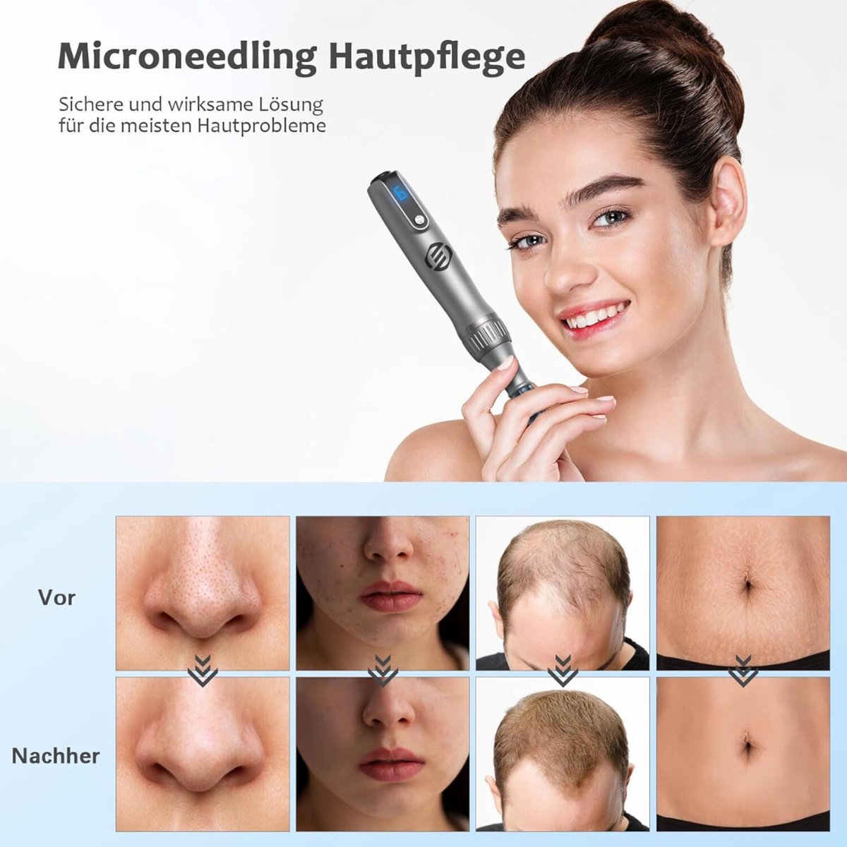 Equivera Laser Plasma Pen - Huidverzorging - Gezicht - Huid - Donkere Vlekken - Sproeten - Pigmentvlekken - Wratten - Tattoo - Moedervlekken - Verwijderaar - Schoonheid - Huidverjonging