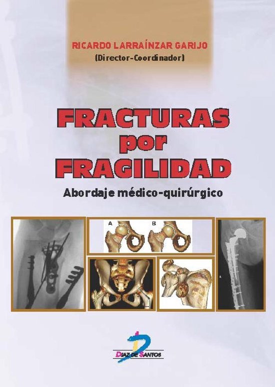 Fracturas por fragilidad - cover