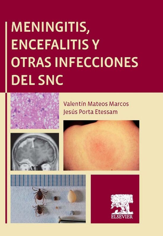 Meningitis, encefalitis y otras infecciones del SNC - cover